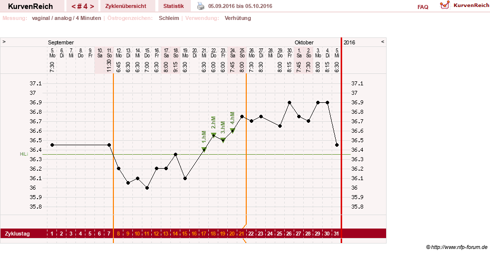 NFP-Kurve User #29124