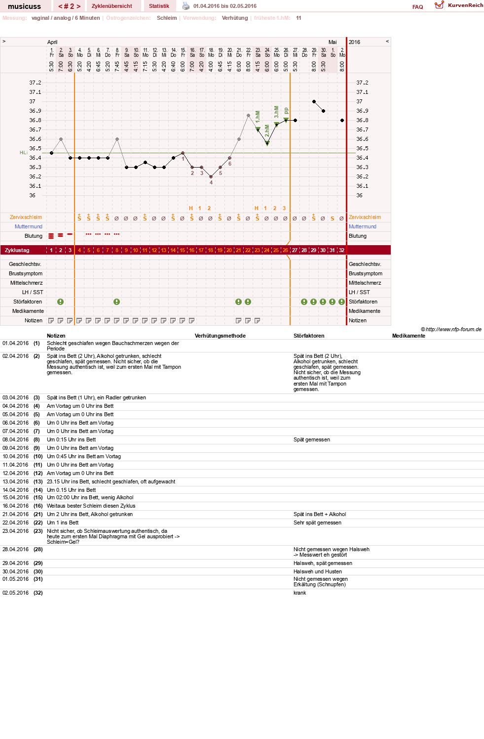 NFP-Kurve User #29157