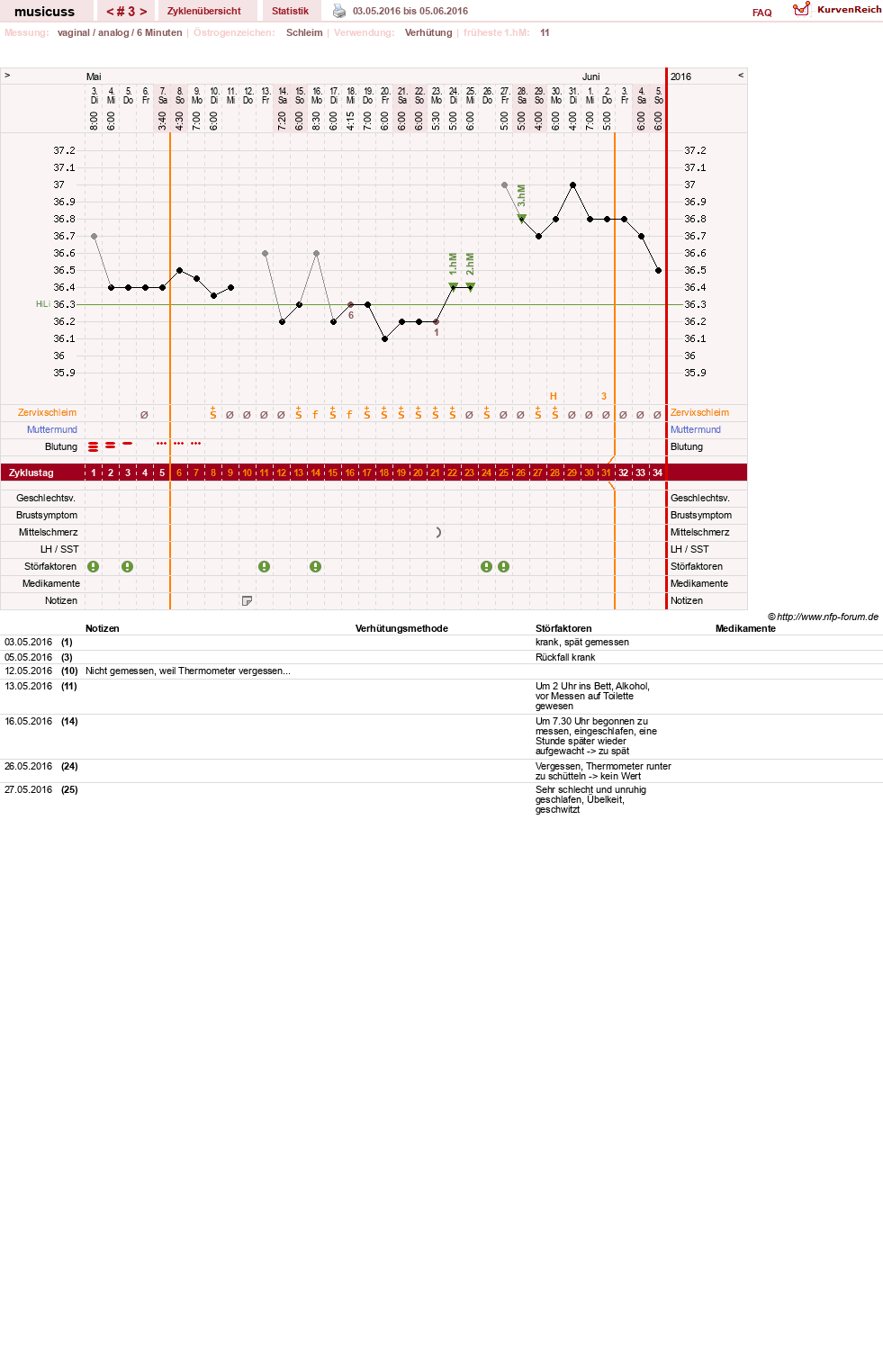 NFP-Kurve User #29157