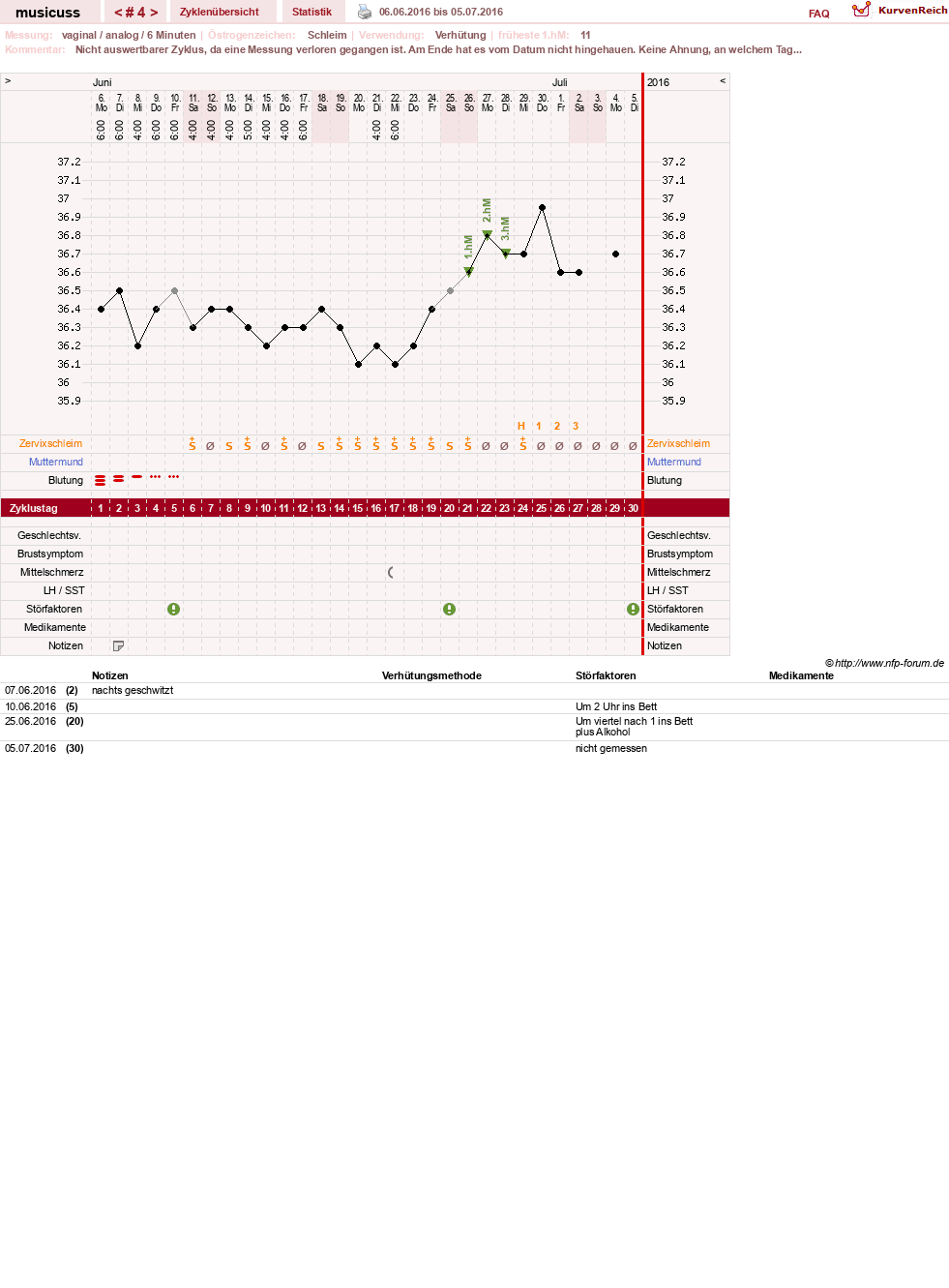 NFP-Kurve User #29157