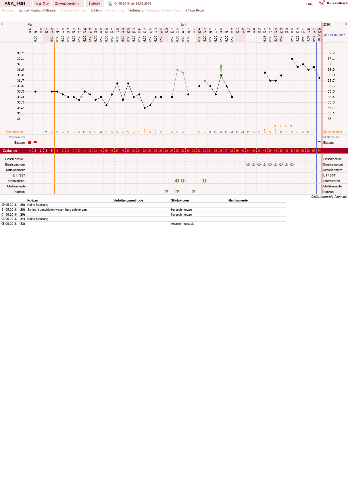 NFP-Kurve User #29232