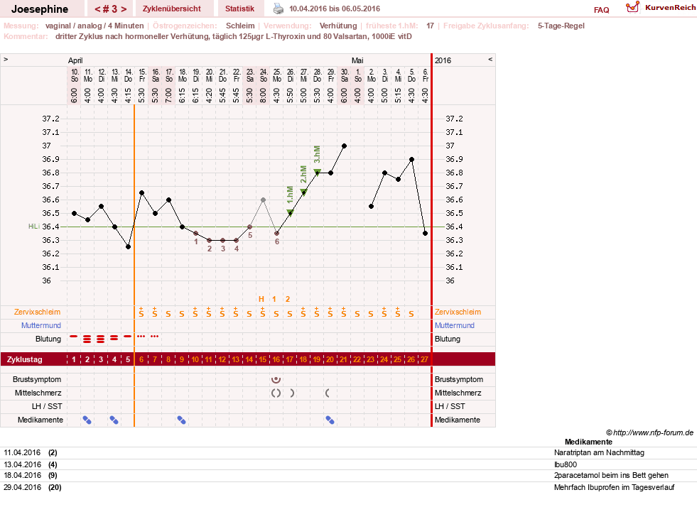 NFP-Kurve User #29242
