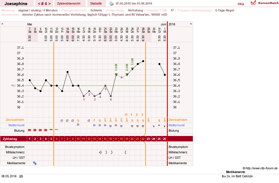 NFP-Kurve User #29242