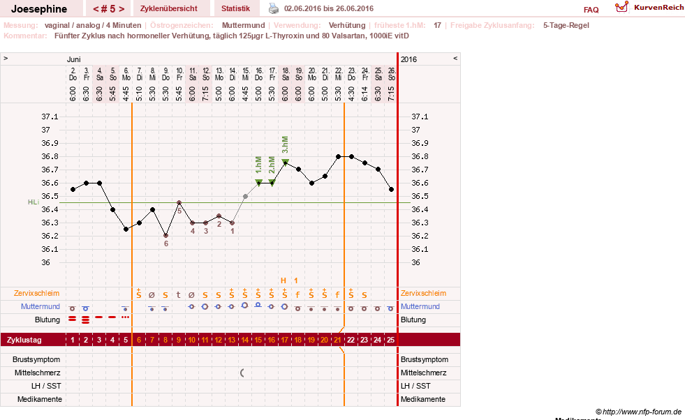 NFP-Kurve User #29242