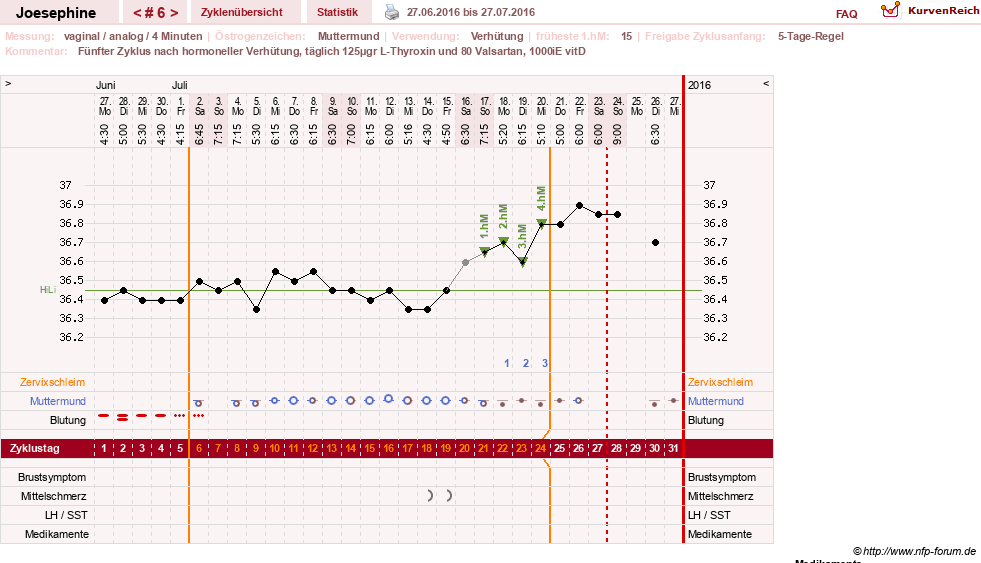 NFP-Kurve User #29242