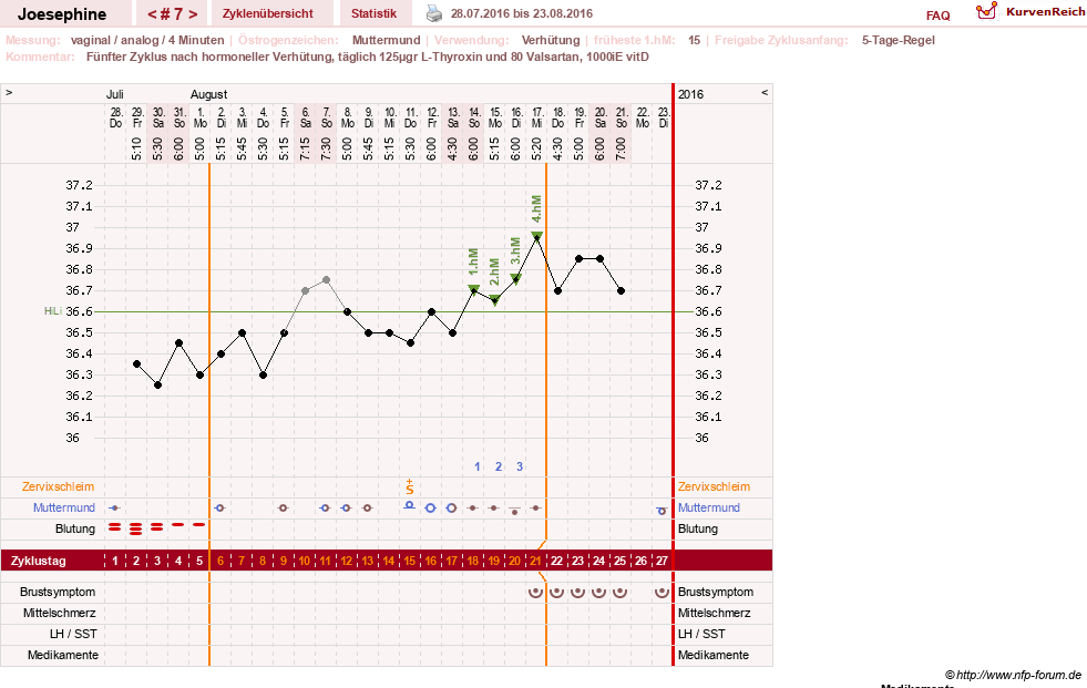 NFP-Kurve User #29242