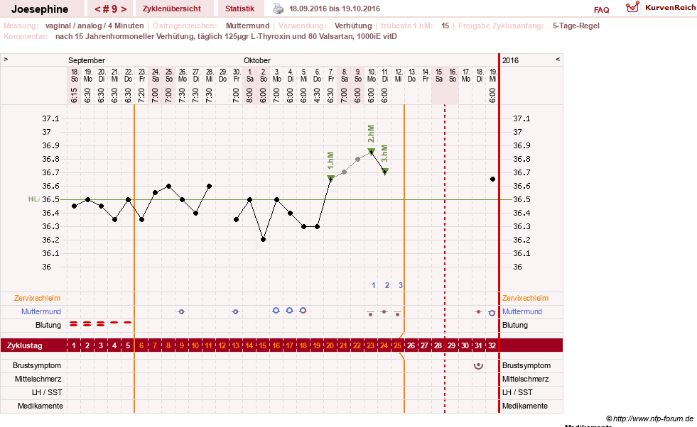 NFP-Kurve User #29242