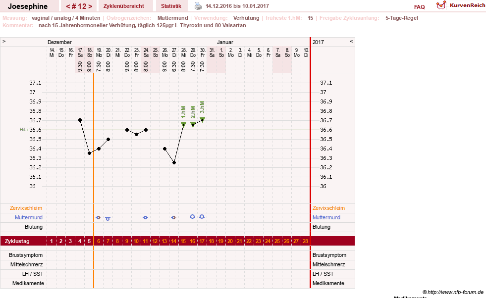 NFP-Kurve User #29242