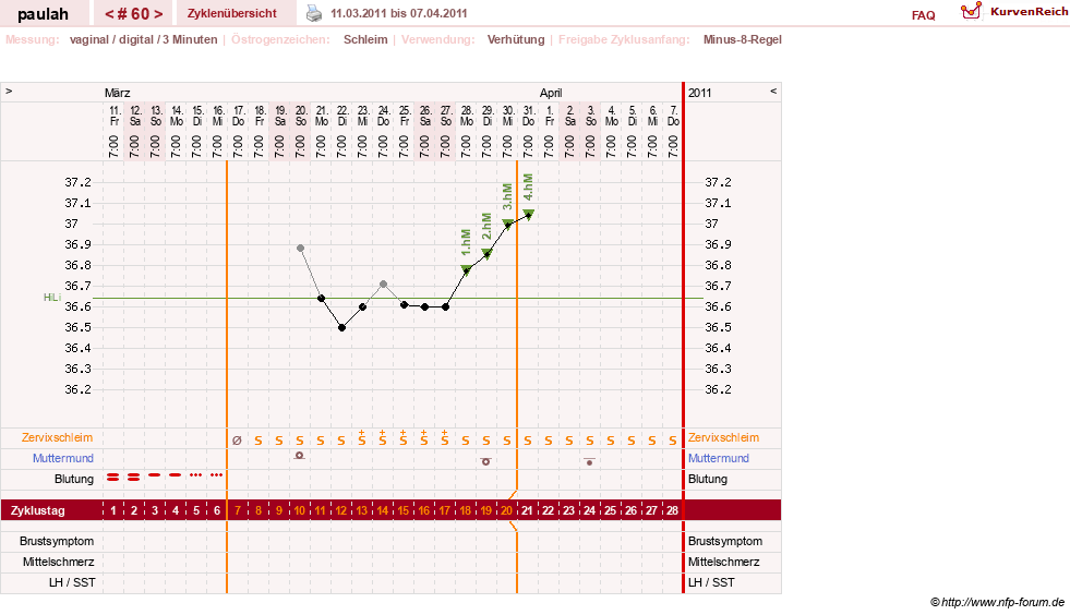 NFP-Kurve User #2925