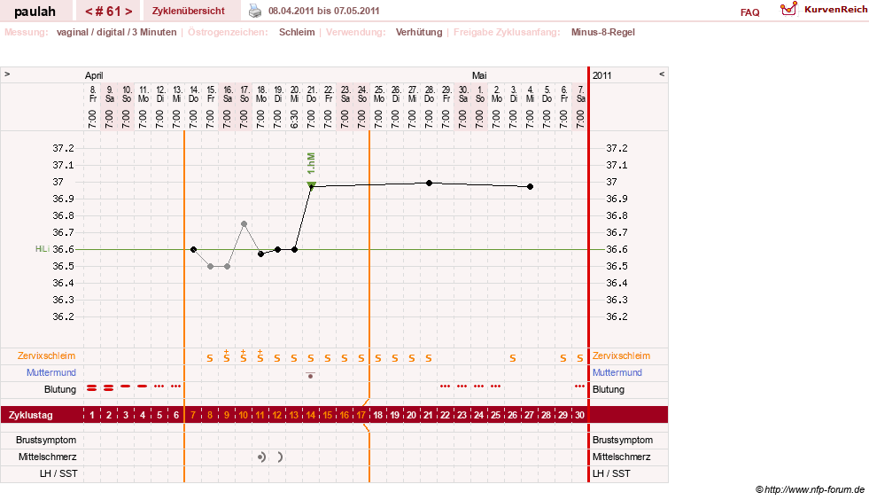 NFP-Kurve User #2925
