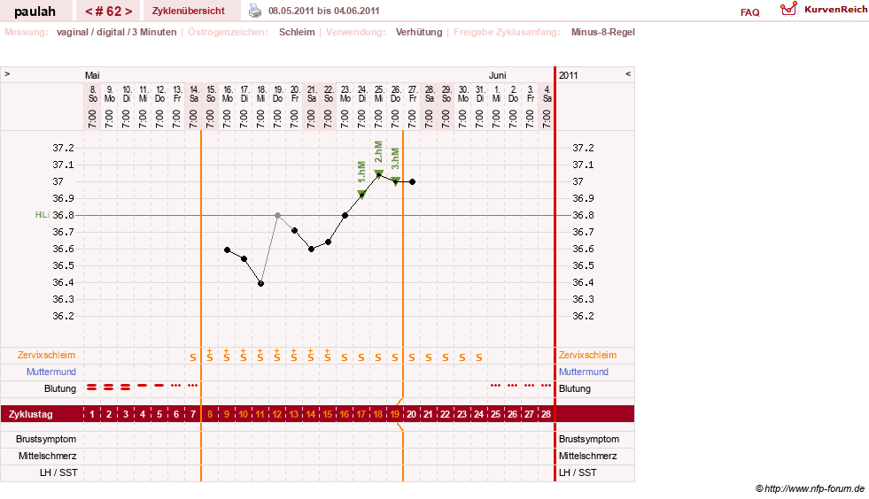 NFP-Kurve User #2925