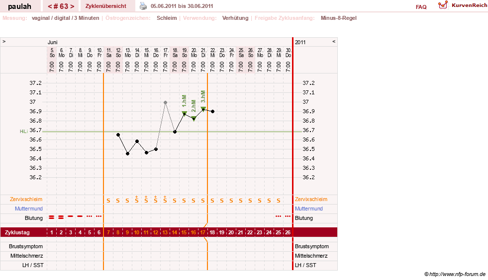 NFP-Kurve User #2925