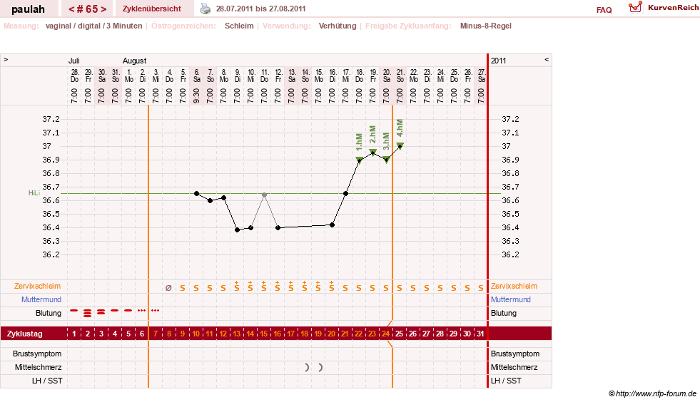 NFP-Kurve User #2925