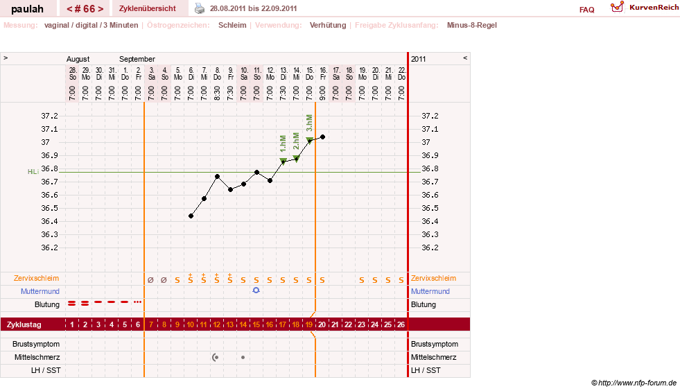NFP-Kurve User #2925