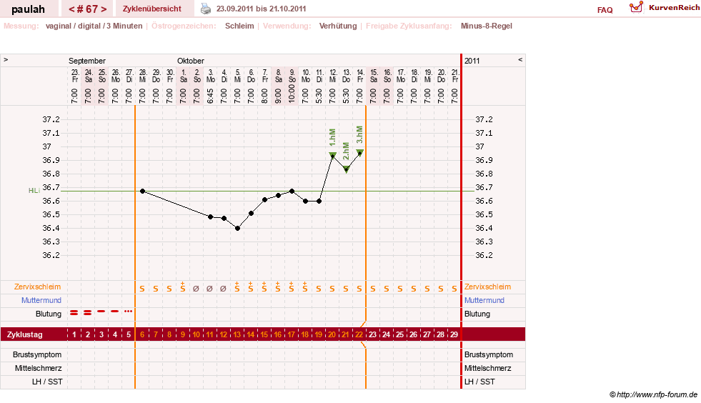 NFP-Kurve User #2925