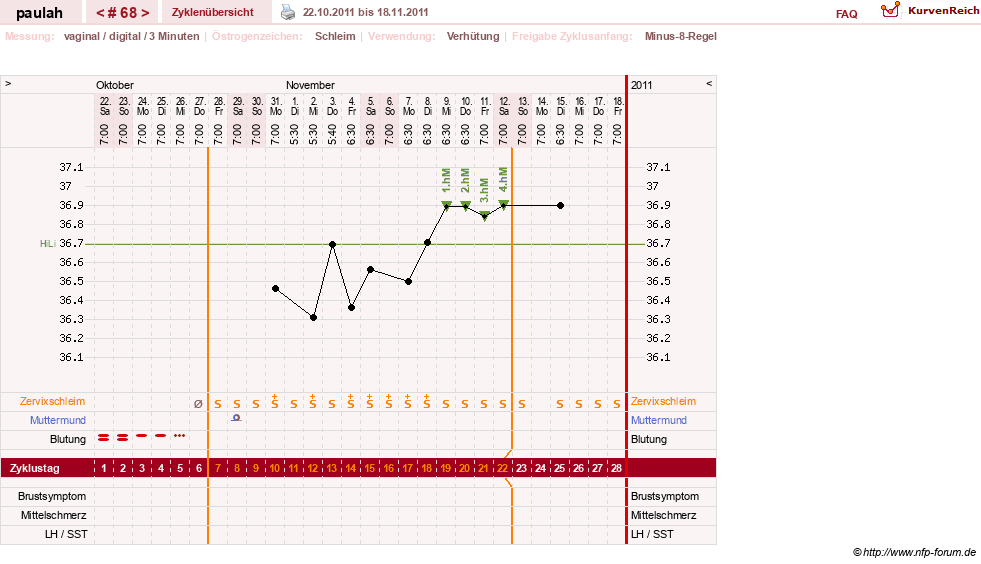 NFP-Kurve User #2925