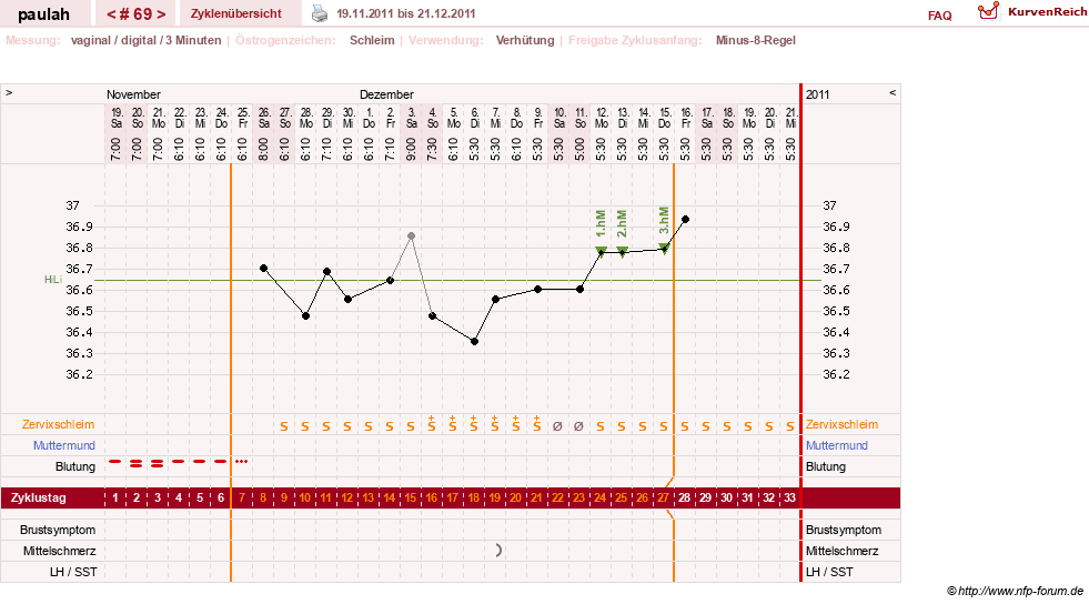 NFP-Kurve User #2925