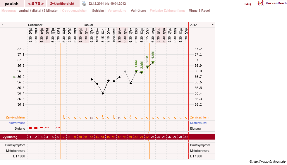 NFP-Kurve User #2925