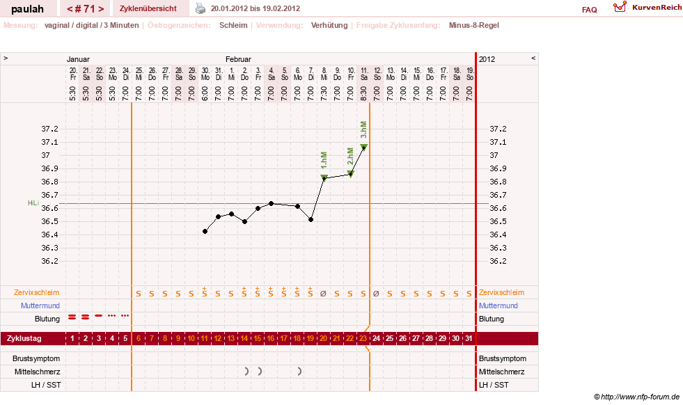 NFP-Kurve User #2925