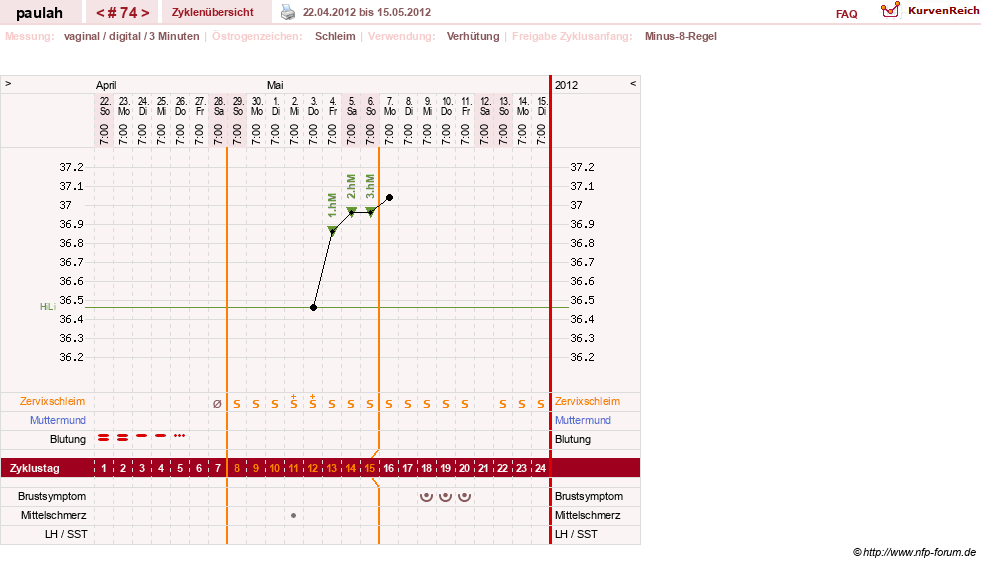 NFP-Kurve User #2925