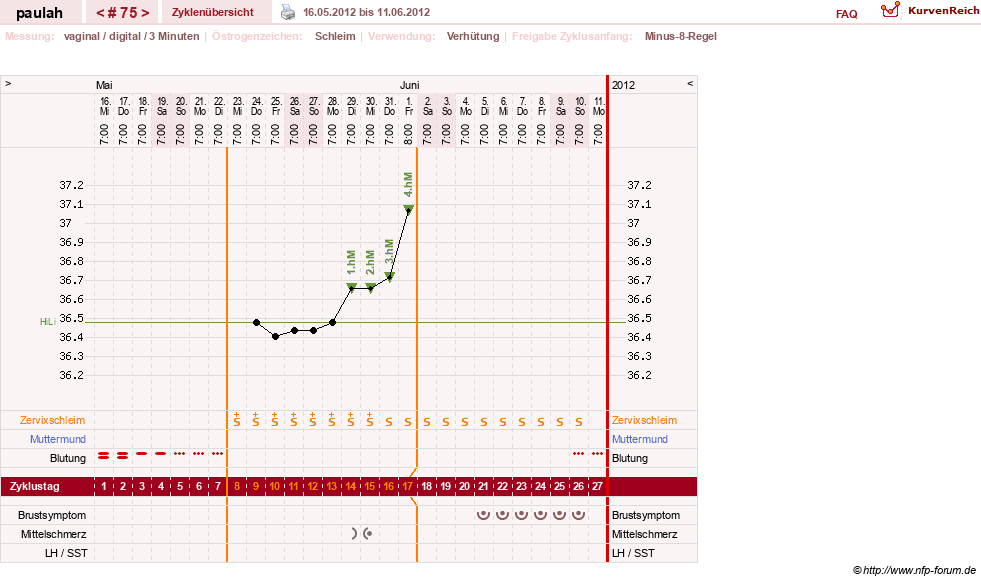 NFP-Kurve User #2925