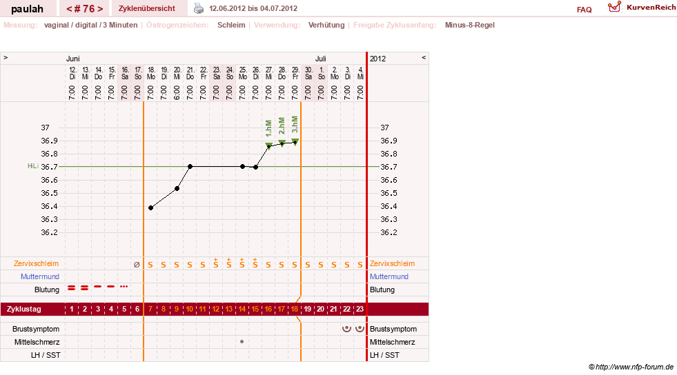 NFP-Kurve User #2925