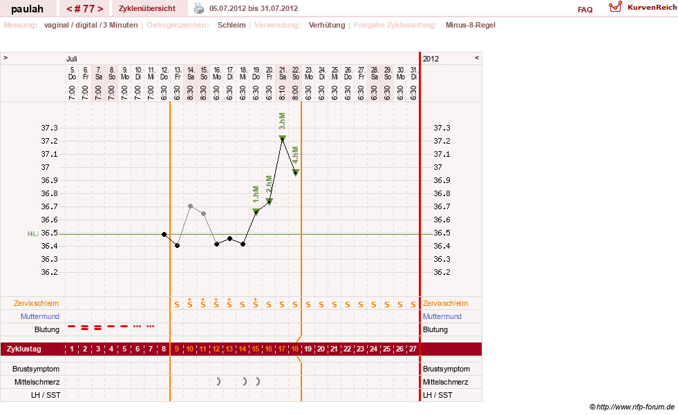NFP-Kurve User #2925
