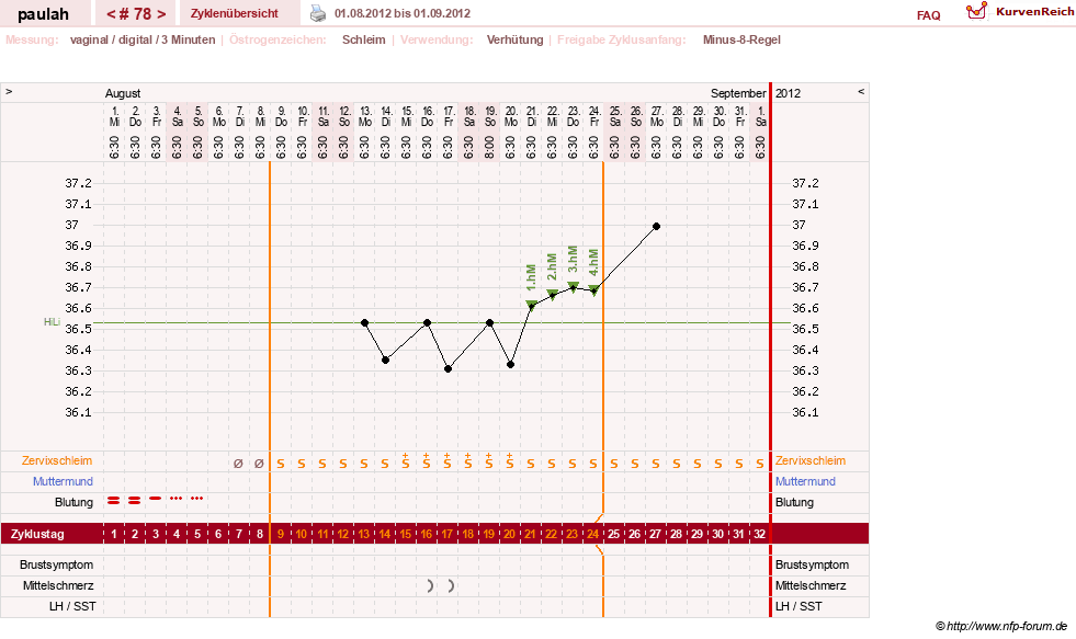 NFP-Kurve User #2925