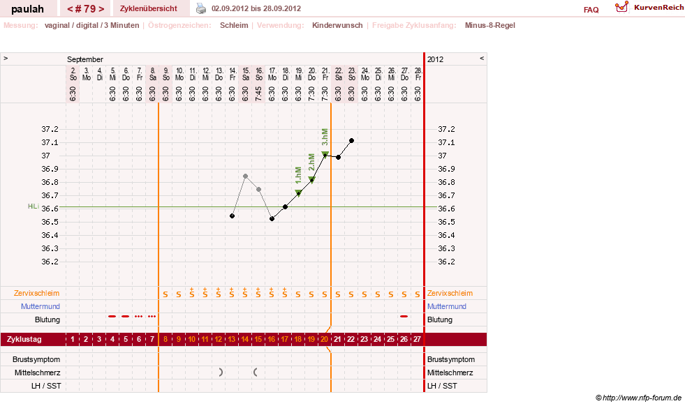 NFP-Kurve User #2925