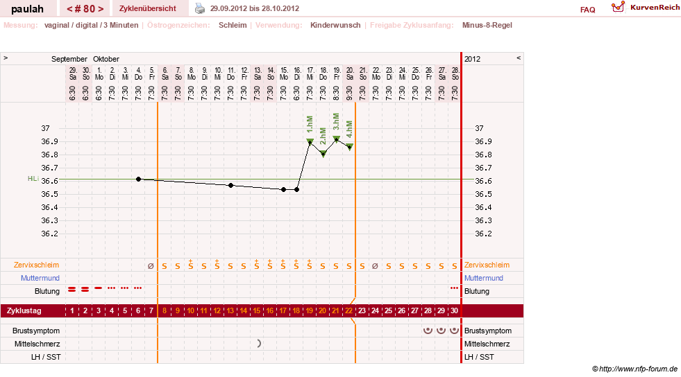 NFP-Kurve User #2925
