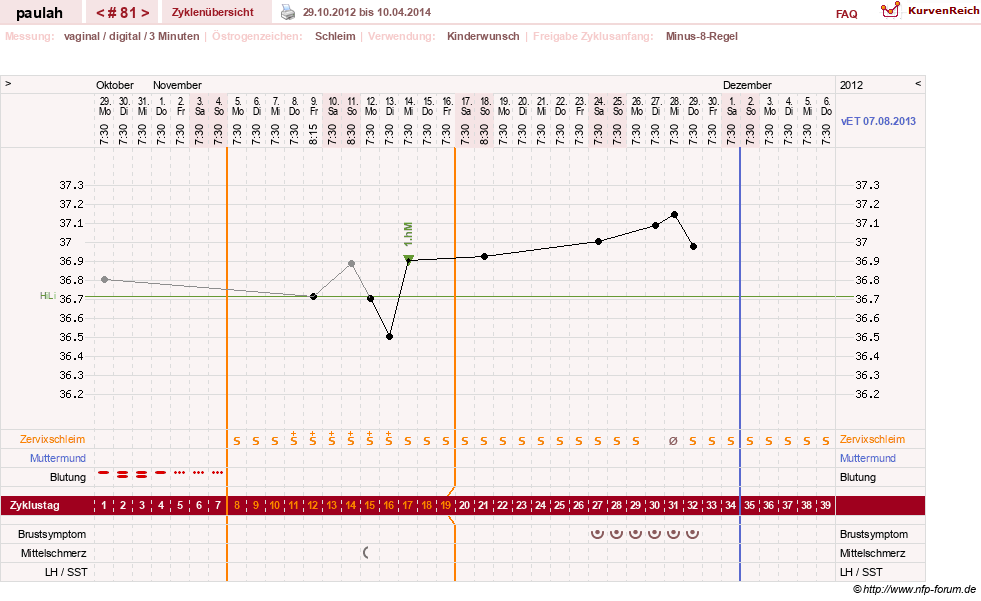 NFP-Kurve User #2925