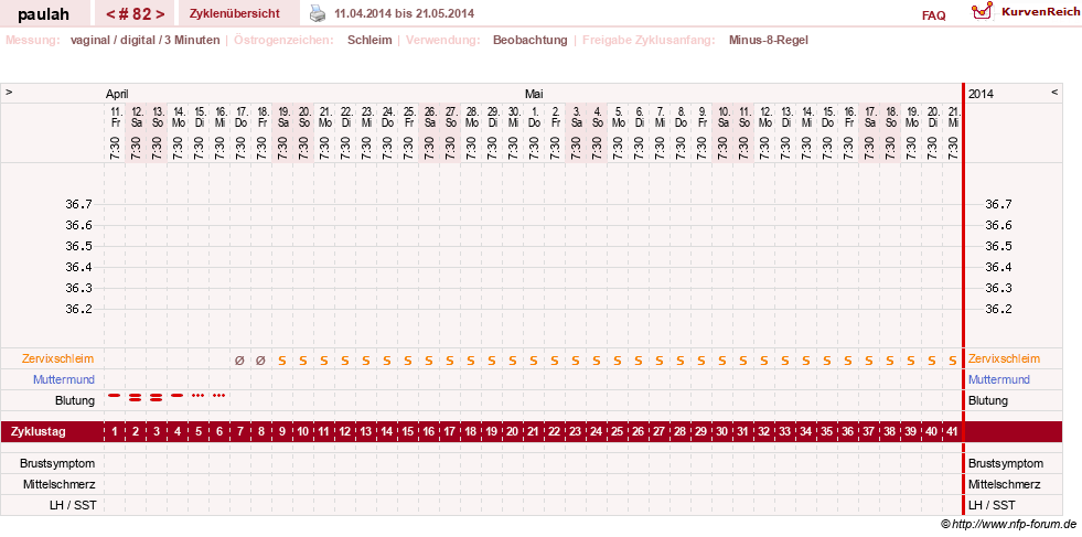 NFP-Kurve User #2925