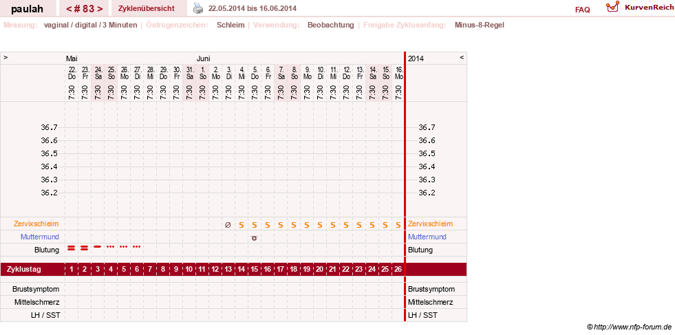 NFP-Kurve User #2925