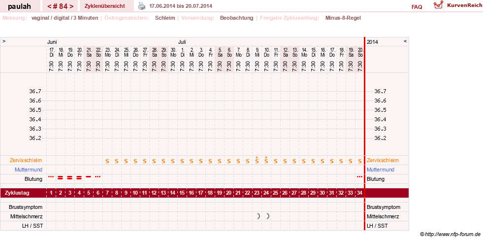 NFP-Kurve User #2925