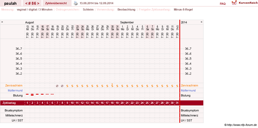 NFP-Kurve User #2925