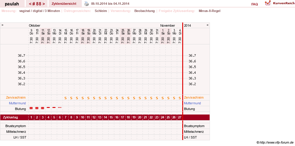 NFP-Kurve User #2925