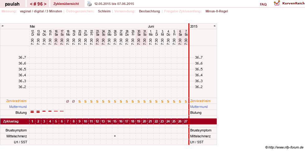 NFP-Kurve User #2925