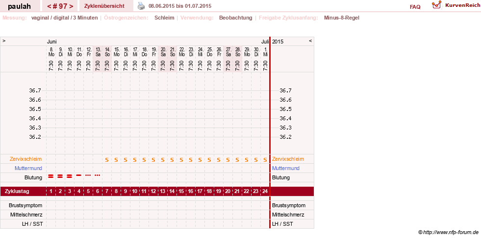 NFP-Kurve User #2925