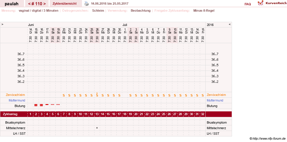NFP-Kurve User #2925