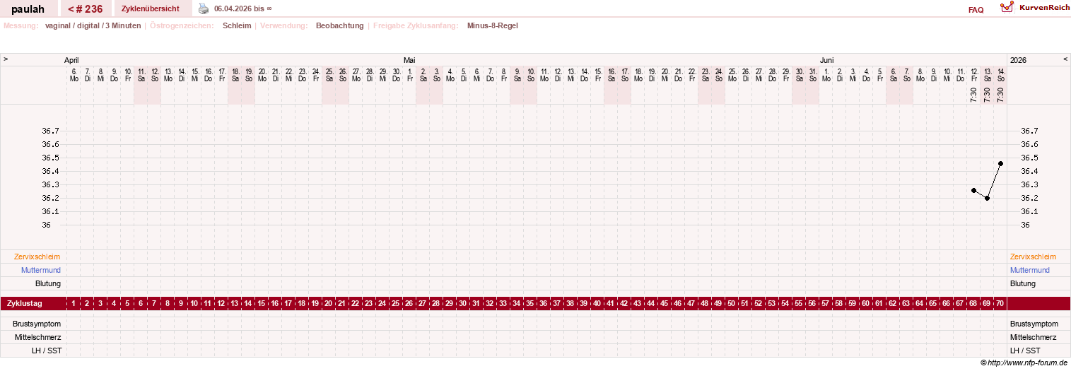 NFP-Kurve User #2925