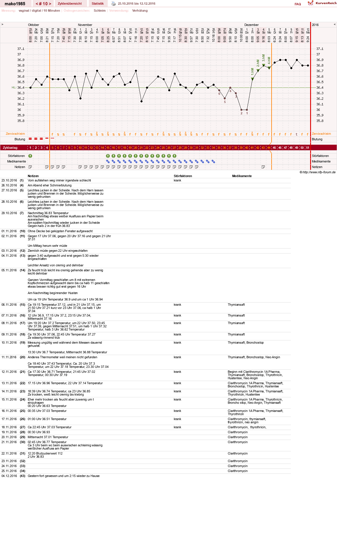 NFP-Kurve User #29289