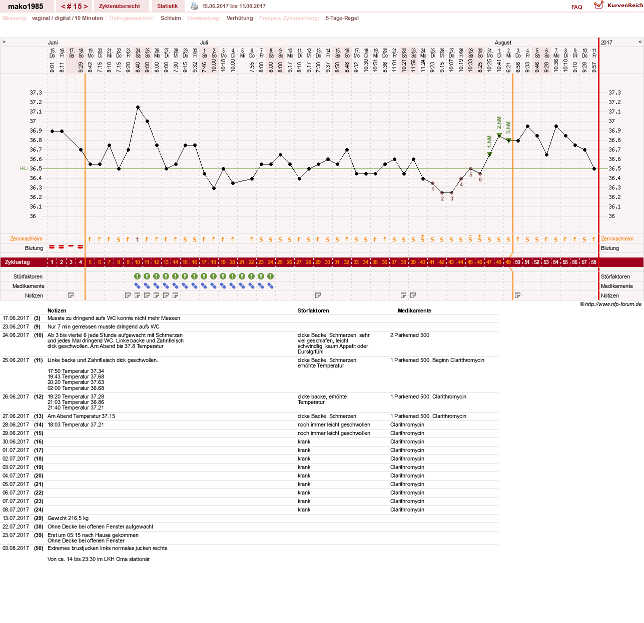 NFP-Kurve User #29289