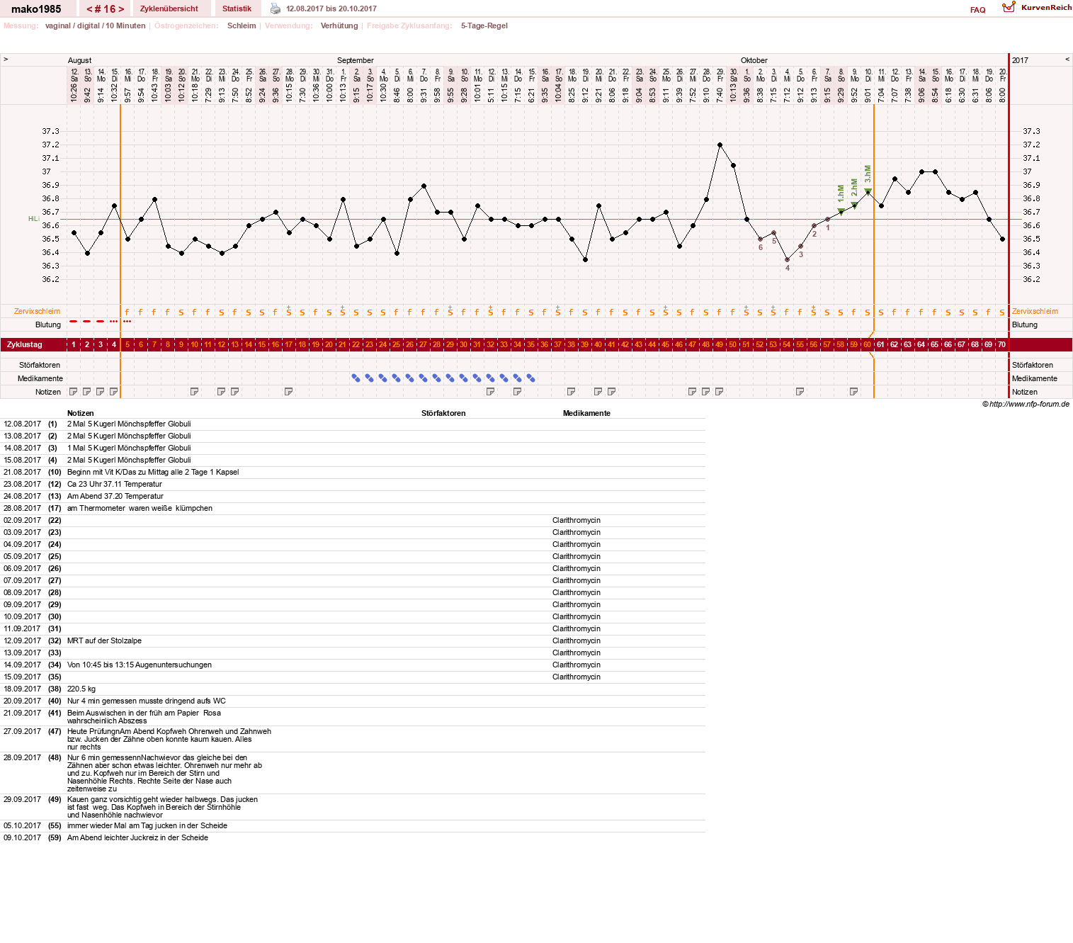 NFP-Kurve User #29289