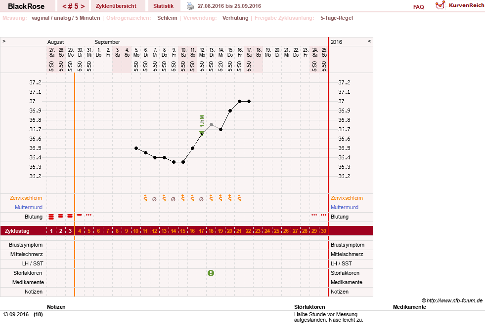NFP-Kurve User #29340