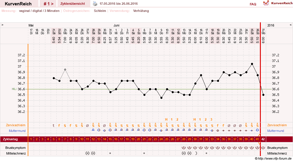 NFP-Kurve User #29406