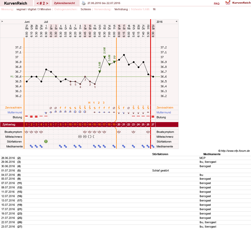 NFP-Kurve User #29406