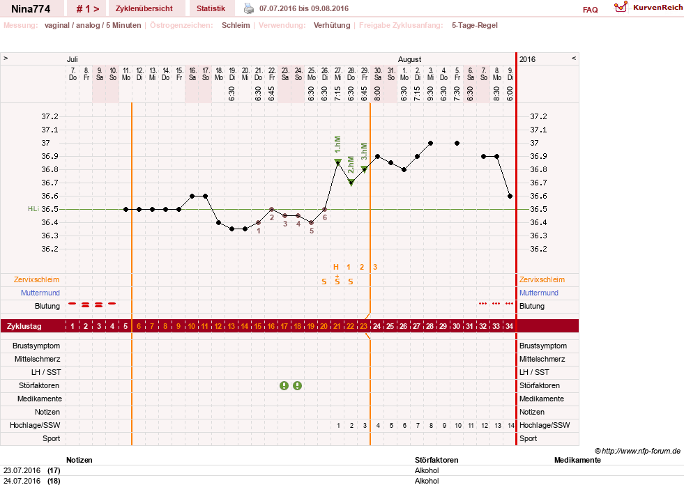 NFP-Kurve User #29626