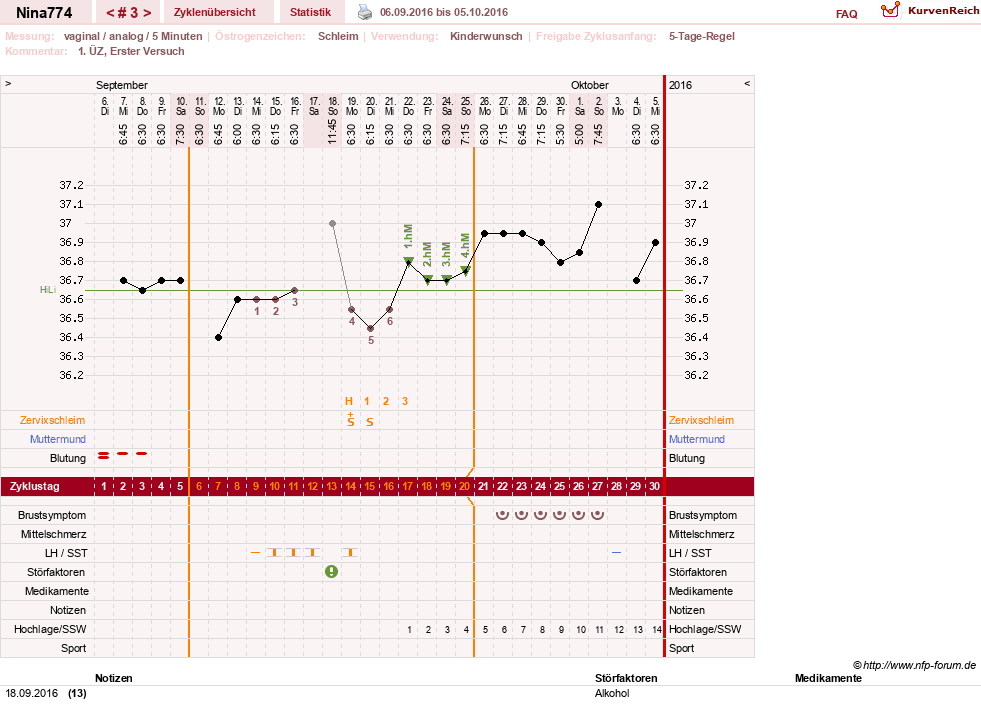 NFP-Kurve User #29626