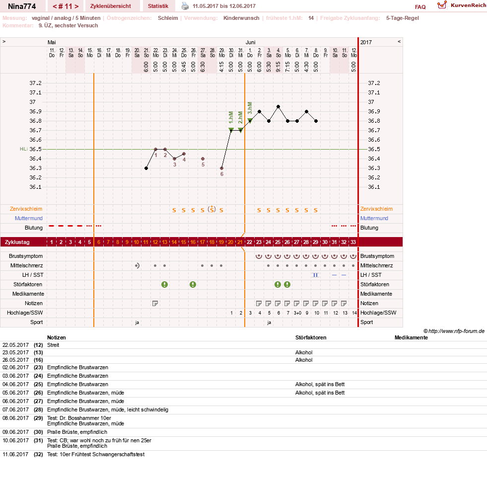 NFP-Kurve User #29626