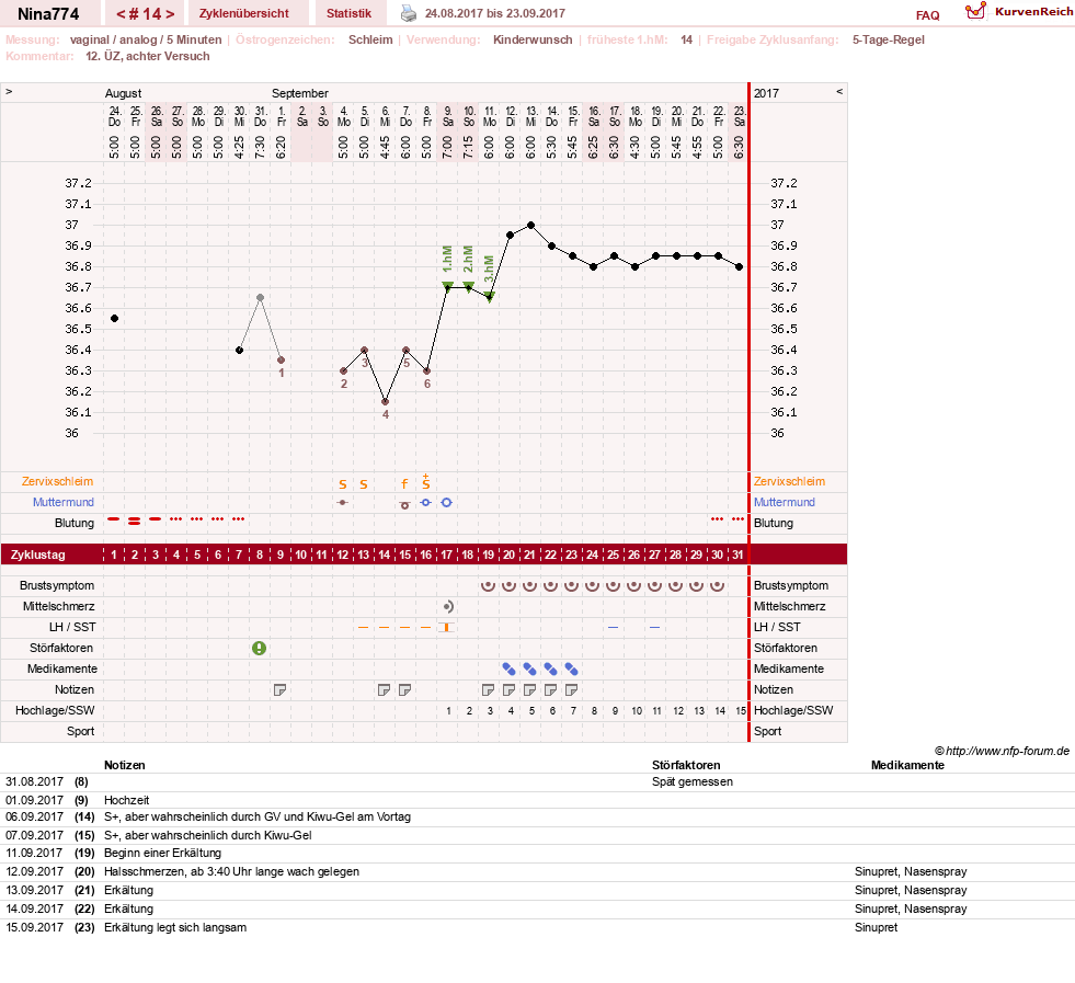 NFP-Kurve User #29626
